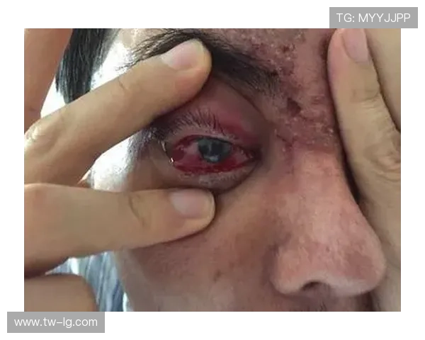 冬奥男选手注射玻尿酸引发热议